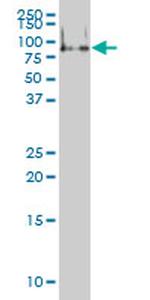 FMR1 Antibody in Western Blot (WB)