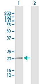 FN1 Antibody in Western Blot (WB)