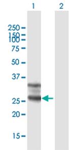FOLR1 Polyclonal Antibody, MaxPab™