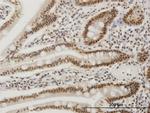 FOSL2 Antibody in Immunohistochemistry (Paraffin) (IHC (P))