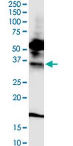 FPR2 Monoclonal Antibody (2G8)