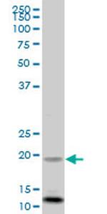 FXN Antibody in Western Blot (WB)