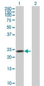 FXN Polyclonal Antibody, MaxPab™