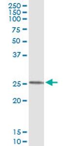 FXN Monoclonal Antibody (1D9)