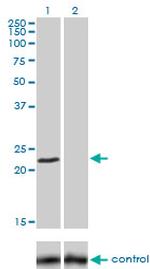 FXN Monoclonal Antibody (3G9)