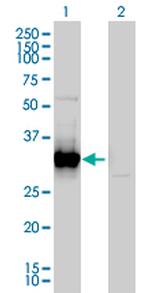 FRG1 Antibody in Western Blot (WB)