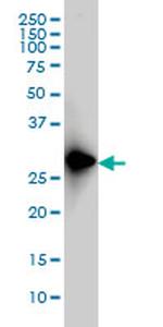 FRG1 Antibody in Western Blot (WB)
