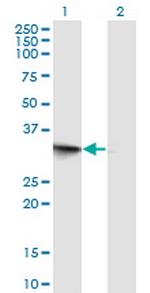 FRG1 Monoclonal Antibody (2B9)