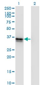 FRZB Monoclonal Antibody (4F7)