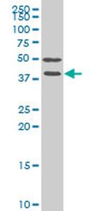 FRZB Monoclonal Antibody (4E5)