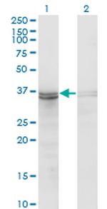FRZB Monoclonal Antibody (3F4)