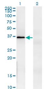 FRZB Monoclonal Antibody (3C3)