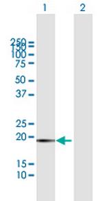 FTL Antibody in Western Blot (WB)