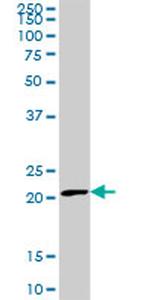 FTL Antibody in Western Blot (WB)