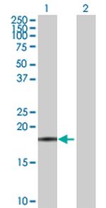 FTL Antibody in Western Blot (WB)