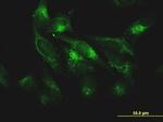 FTL Antibody in Immunocytochemistry (ICC/IF)