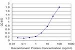 FTL Antibody in ELISA (ELISA)