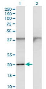 FTL Antibody in Western Blot (WB)