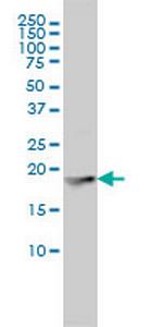 FTL Antibody in Western Blot (WB)