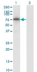 ADAM2 Monoclonal Antibody (1B8)