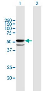 FUCA1 Polyclonal Antibody, MaxPab™