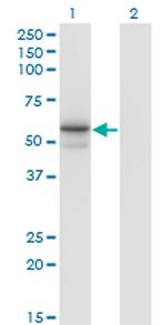FUCA1 Monoclonal Antibody (1D4)