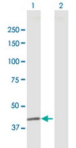 FUT3 Polyclonal Antibody, MaxPab™