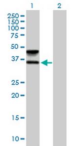 FUT6 Polyclonal Antibody, MaxPab™