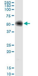 G6PD Antibody in Western Blot (WB)