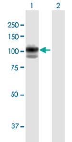 GAA Polyclonal Antibody, MaxPab™
