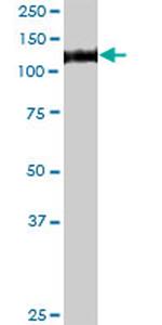 GAA Antibody in Western Blot (WB)