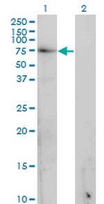 GAD1 Monoclonal Antibody (5E11)