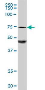 GALC Antibody in Western Blot (WB)