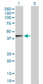 B4GALNT1 Polyclonal Antibody, MaxPab™