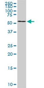 B4GALNT1 Antibody in Western Blot (WB)