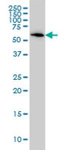 B4GALNT1 Antibody in Western Blot (WB)