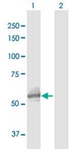 GALNS Polyclonal Antibody, MaxPab™