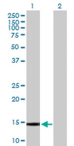 GALNT1 Polyclonal Antibody, MaxPab™