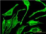 GALNT1 Monoclonal Antibody (3C10)