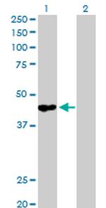 GALT Antibody in Western Blot (WB)