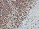 GALT Monoclonal Antibody (4C11)