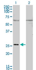 GAP43 Monoclonal Antibody (3C11)