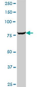 GARS Antibody in Western Blot (WB)