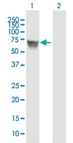 GBA Polyclonal Antibody, MaxPab™