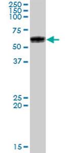 GBA Antibody in Western Blot (WB)