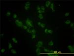 GBA Monoclonal Antibody (2E2)