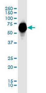 GBA Monoclonal Antibody (200)
