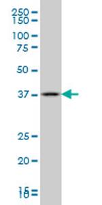 GBX2 Antibody in Western Blot (WB)