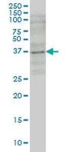 GBX2 Monoclonal Antibody (1A7)