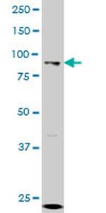 GCN5L2 Antibody in Western Blot (WB)